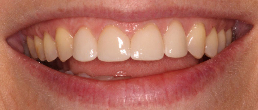 Dentist in Lake Zurich