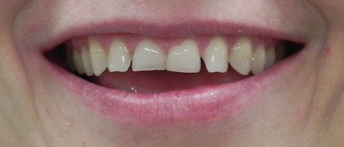 Cosmetic Dentist in Lake Zurich