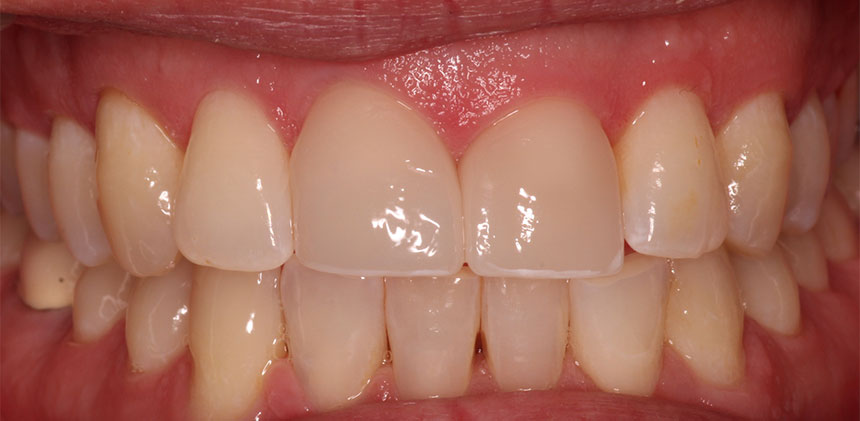 Lake Zurich Dental Office