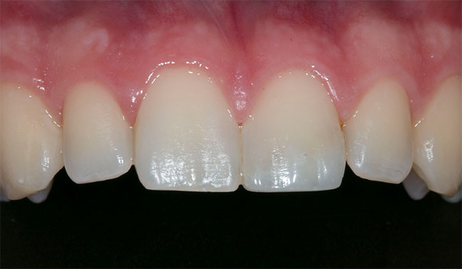 Dentist in Lake Zurich