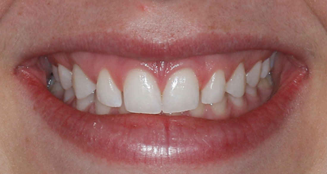 Cosmetic Dentist in Lake Zurich