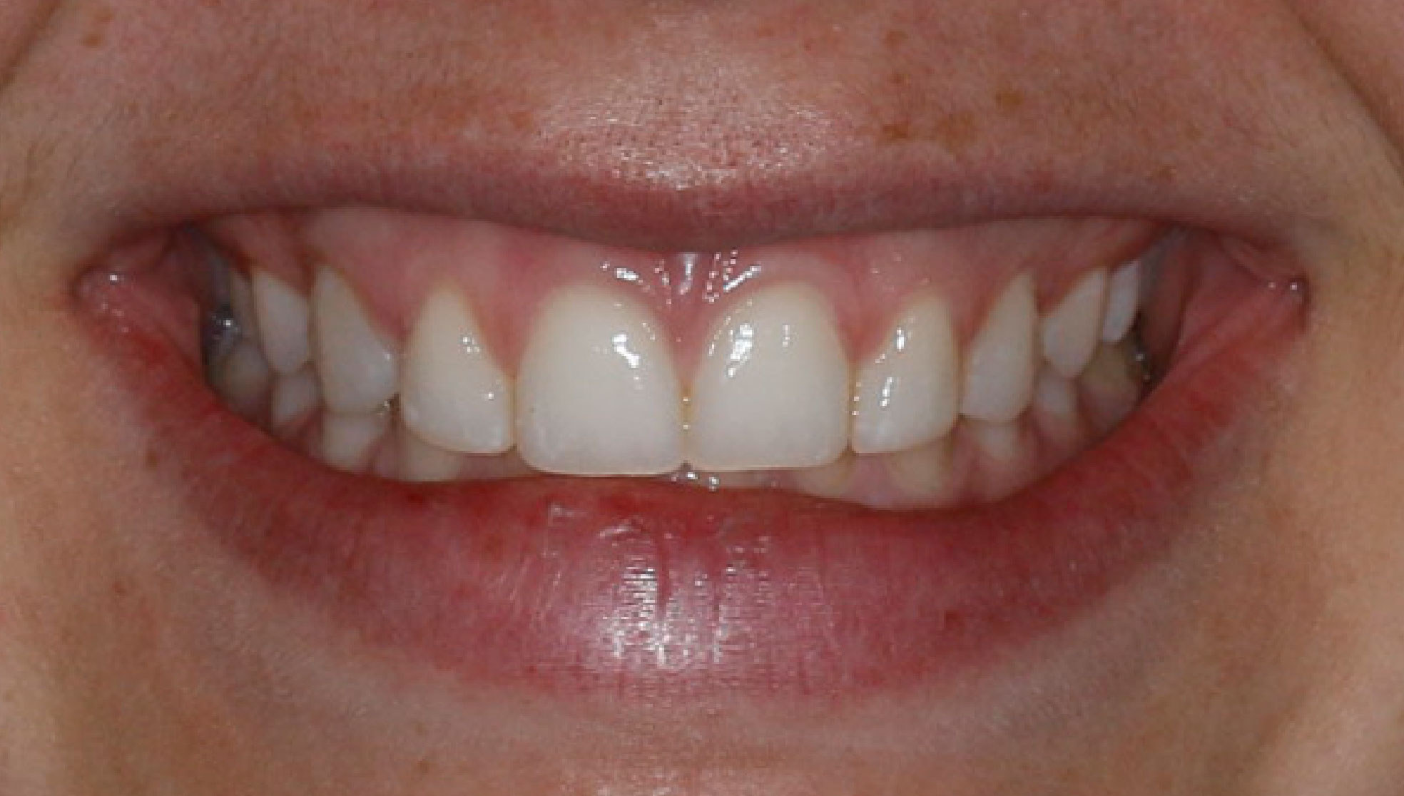 Cosmetic Dentist in Lake Zurich