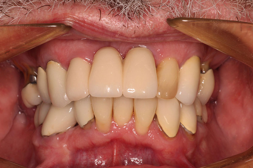 Cosmetic Dentist in Lake Zurich