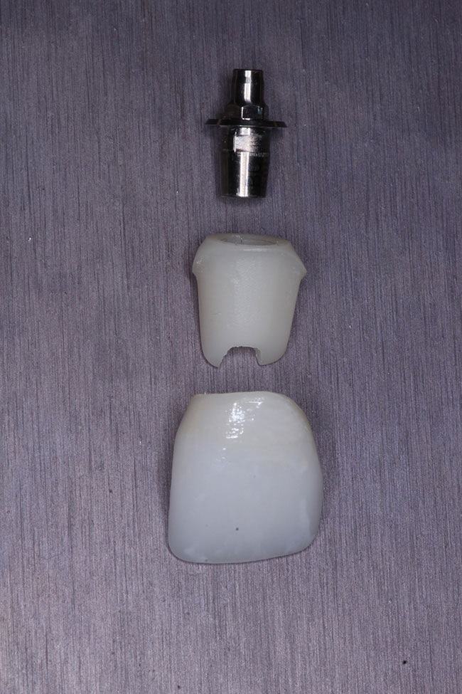 Lake Zurich Dental Office