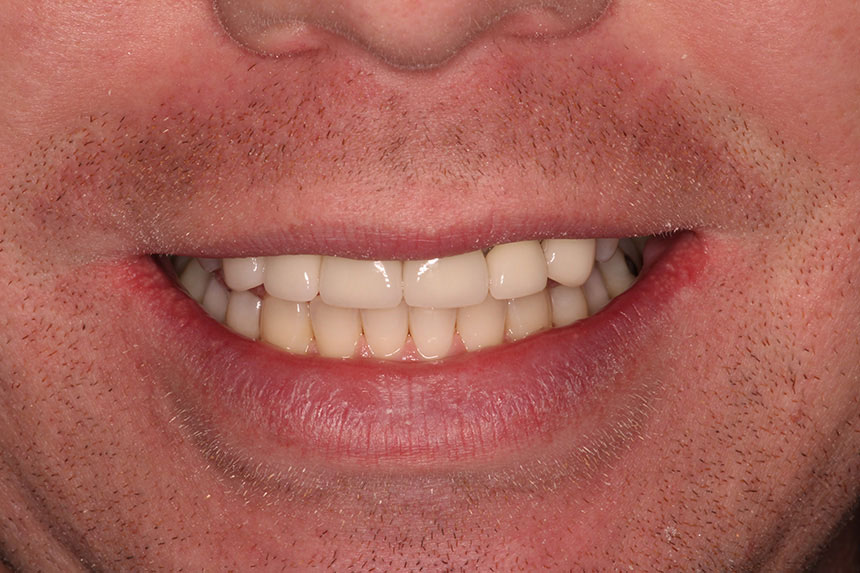 Teledentistry in Lake Zurich