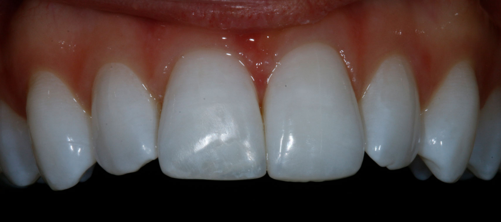 Teledentistry in Lake Zurich