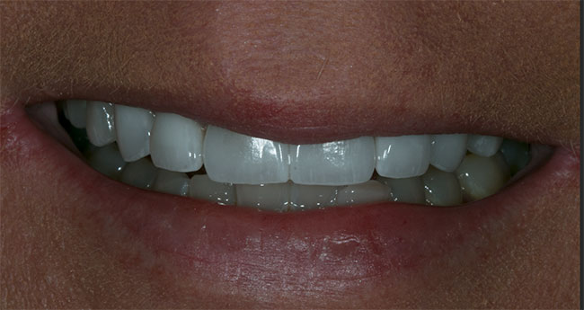 Teledentistry in Lake Zurich