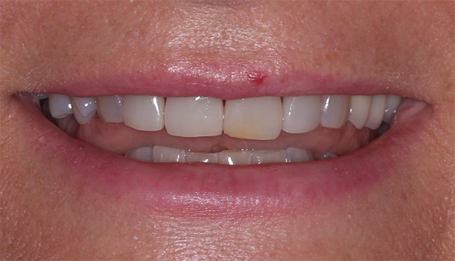 Cosmetic Dentist in Lake Zurich