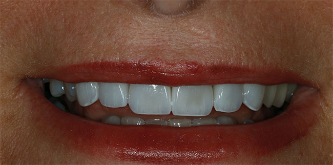 Dentist in Lake Zurich