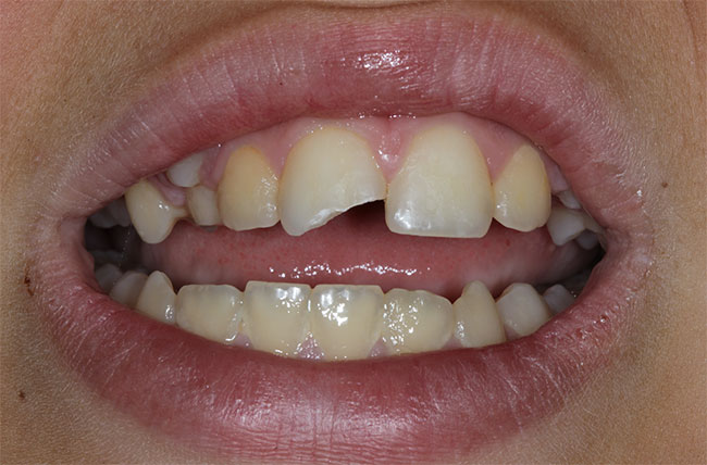 Lake Zurich Dental Office