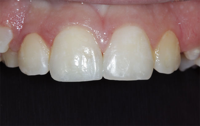 Lake Zurich Dental Office