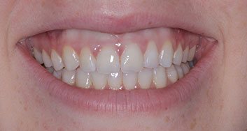 Teledentistry in Lake Zurich;