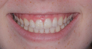 Lake Zurich Dental Office